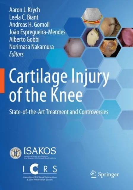 Coperta cărții "Cartilage Injury of the Knee" de Aaron J. Krych, Leela C. Biant, Andreas H. Gomoll, Alberto Gobbi, Norimasa Nakamura, João Espregueira-Mendes