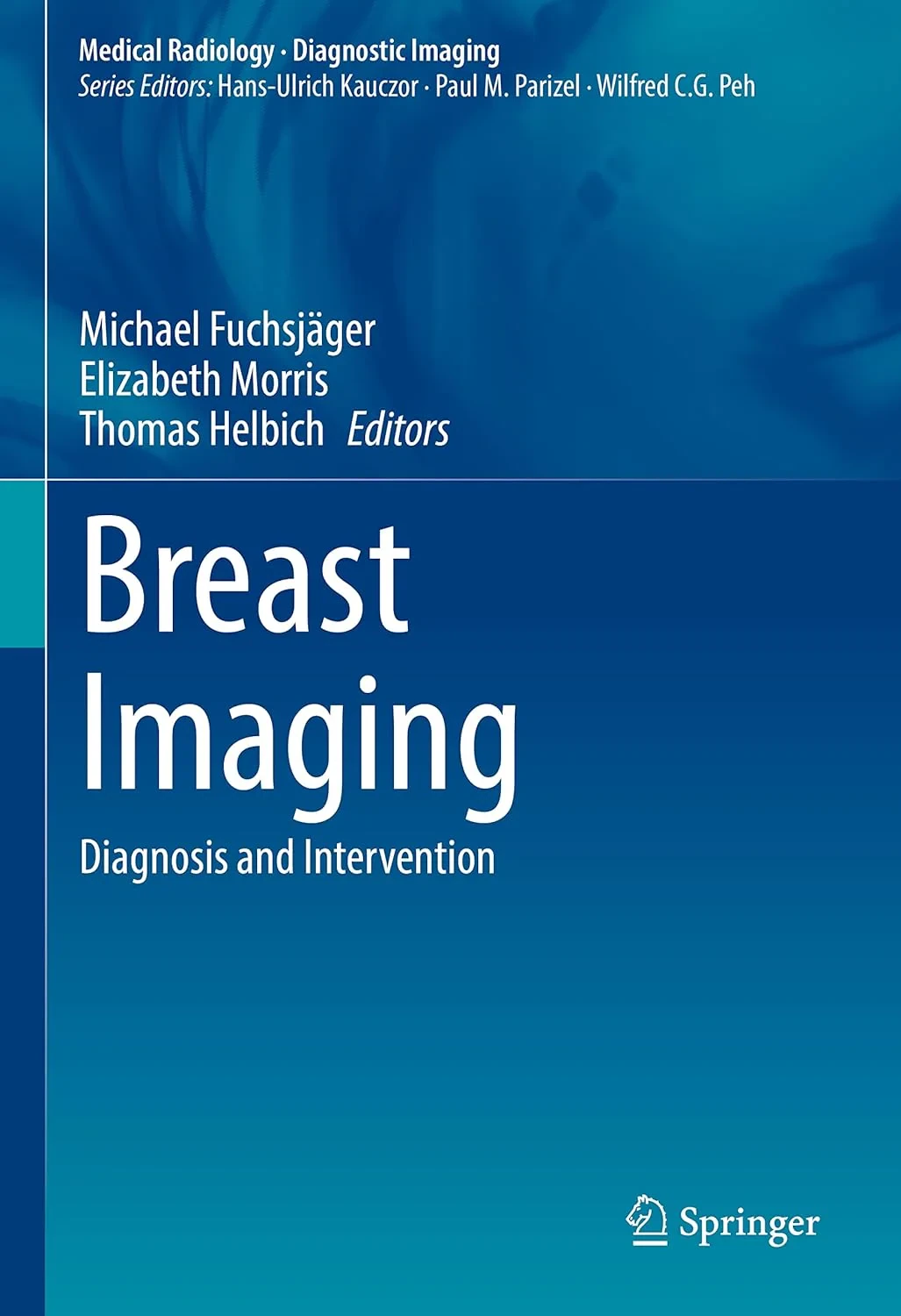 Coperta cărții "Breast Imaging. Diagnosis and Intervention" de Michael Fuchsjäger, Elizabeth Morris, Thomas Helbich