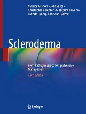 Coperta cărții "Scleroderma: From Pathogenesis to Comprehensive Management" de Yannick Allanore, John Varga, Christopher P. Denton, Masataka Kuwana, Lorinda Chung, Ami Shah