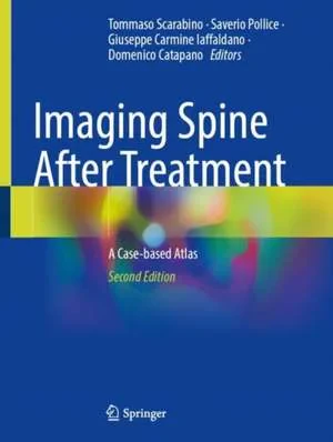 Coperta cărții "Imaging Spine After Treatment: A Case-based Atlas" de Tommaso Scarabino, Saverio Pollice, Giuseppe Carmine Iaffaldano, Domenico Catapano