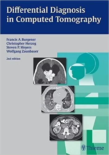 Coperta cărții "Differential Diagnosis in Computed Tomography" de Francis Burgener