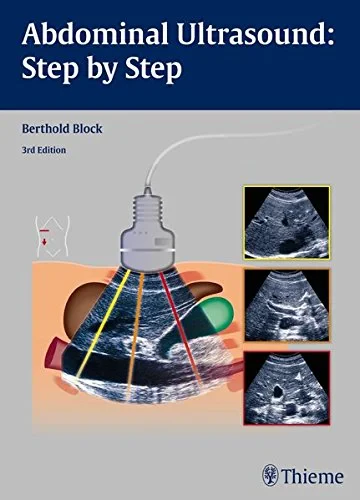 Coperta cărții "Abdominal Ultrasound: Step by Step" de Berthold Block