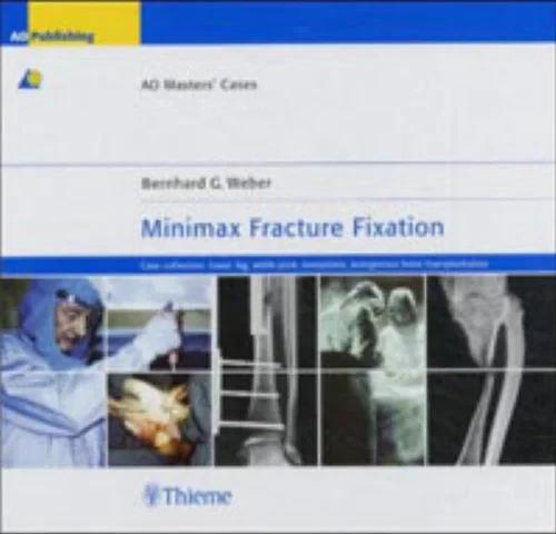 Minimax Fracture Fixation: Case Collection - Lower...