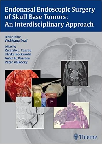Coperta cărții "Endonasal Endoscopic Surgery of Skull Base Tumors: An Interdisciplinary Approach 1st edition Edition" de Wolfgang Draf (Editor), Ricardo L. Carrau (Editor), Ulrike Bockmuehl (Editor), Amin Kassam (Editor), Peter Vajkoczy (Editor)