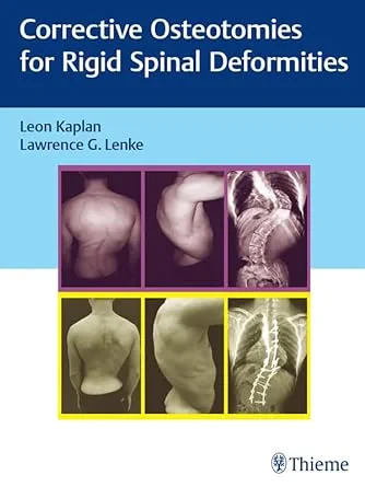 Coperta cărții "Corrective Osteotomies for Rigid Spinal Deformities" de Leon Kaplan, Lawrence G. Lenke