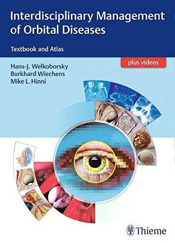 Coperta cărții "Interdisciplinary Management of Orbital Diseases: Textbook and Atlas " de Hans-Jurgen Welkoborsky, Burkhard Wiechens, Michael L. Hinni