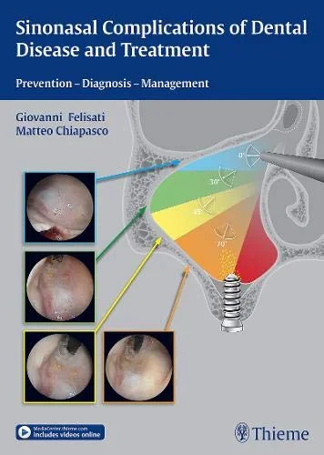 Coperta cărții "Sinonasal Complications of Dental Disease and Treatment" de Giovanni Felisati, Matteo Chiapsco