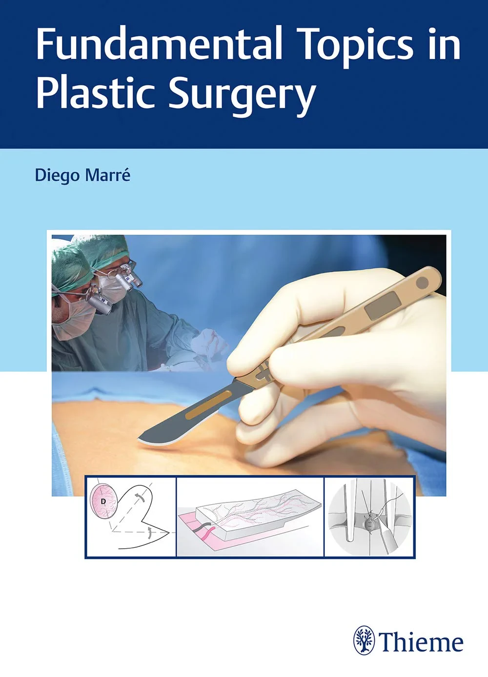 Coperta cărții "Fundamental Topics in Plastic Surgery" de Diego Marre