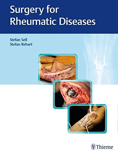 Coperta cărții " Surgery for Rheumatic Diseases" de Stefan Sell, Stefan Rehart