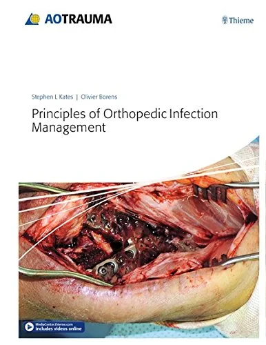 Coperta cărții " Principles of Orthopedic Infection Management" de Stephen Kates, Olivier Borens