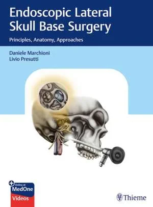 Coperta cărții "Endoscopic Lateral Skull Base Surgery " de Daniele Marchioni, Livio Presutti