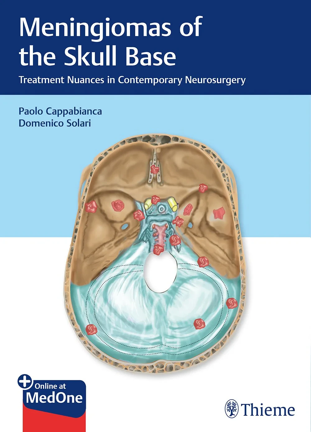 Coperta cărții "Meningiomas of the Skull Base: Treatment Nuances in Contemporary Neurosurgery " de Paolo Cappabianca, Domenico Solari