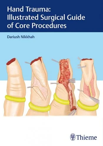 Coperta cărții "Hand Trauma: Illustrated Surgical Guide of Core Procedures" de Dariush Nikkhah
