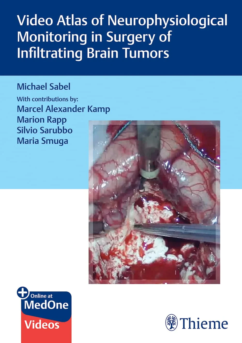 Coperta cărții "Video Atlas of Neurophysiological Monitoring in Surgery of Infiltrating Brain Tumors" de Michael Sabel