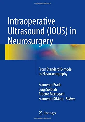 Coperta cărții "Intraoperative Ultrasound (IOUS) in Neurosurgery" de Francesco Prada, Luigi Solbiati, Alberto Martegani, Francesco DiMeco