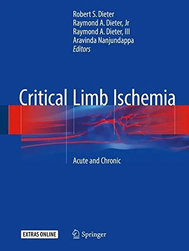 Coperta cărții "Critical Limb Ischemia: Acute and Chronic" de Robert S. Dieter, Raymond A. Dieter Jr, Raymond A. Dieter III