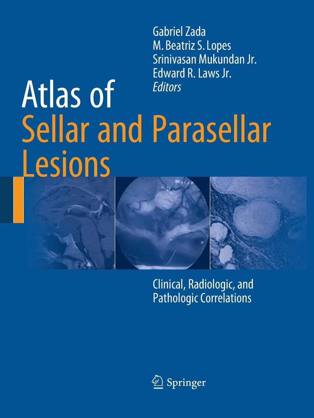 Coperta cărții "Atlas of Sellar and Parasellar Lesions" de Zada