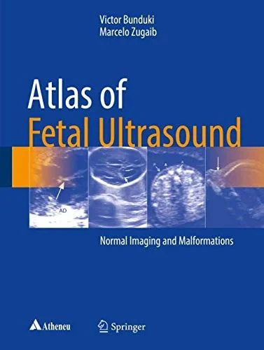 Atlas of Fetal Ultrasound Normal Imaging and Malfo...