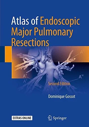 Coperta cărții "Atlas of Endoscopic Major Pulmonary Resections" de Dominique Gossot