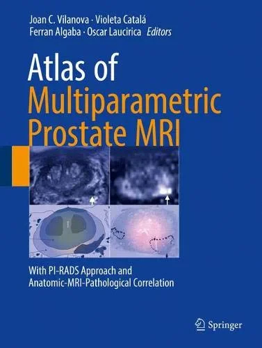 Coperta cărții "Atlas of Multiparametric Prostate MRI" de Joan C. Vilanova, Ferran Algaba, Oscar Laucirica, Violeta Catalá