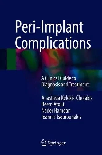 Coperta cărții "Peri-Implant Complications: A Clinical Guide to Diagnosis and Treatment" de R., N., A., I., Kelekis-Cholakis, Atout, Hamdan, Tsourounakis