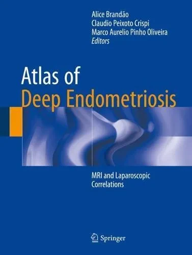 Coperta cărții "Atlas of Deep Endometriosis: MRI and Laparoscopic Correlations" de Claudio Peixoto Crispi, Marco Aurelio Pinho Oliveira, Alice Brandão