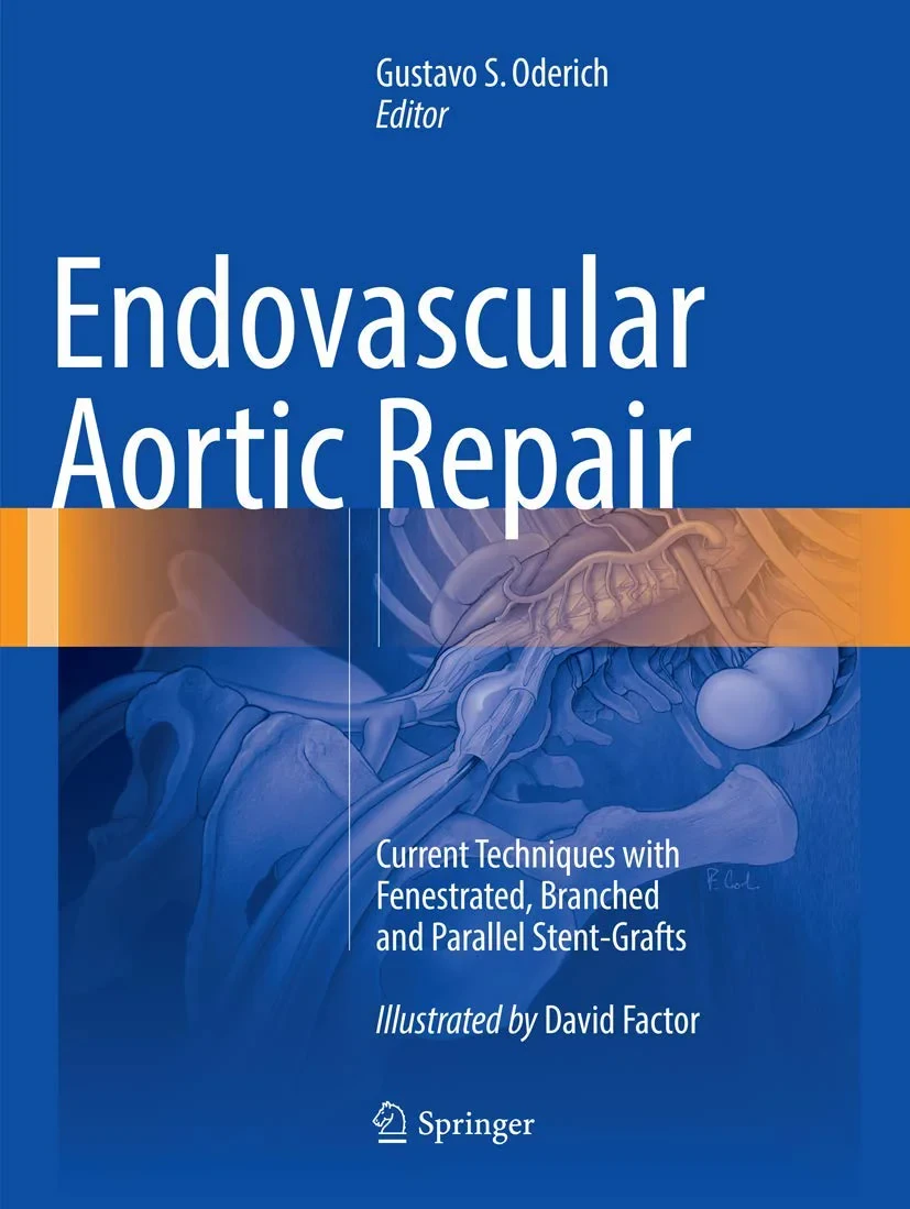 Coperta cărții "Endovascular Aortic Repair: Current Techniques with Fenestrated, Branched and Parallel Stent-Grafts" de Gustavo S. Oderich, David Factor