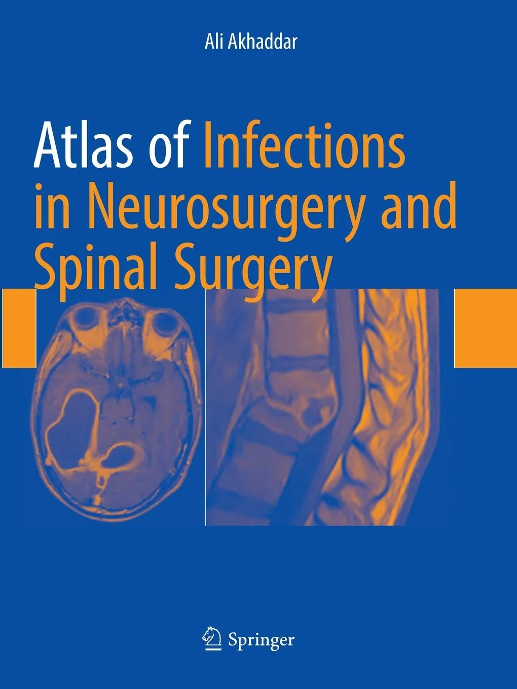 Coperta cărții "Atlas of Infections in Neurosurgery and Spinal Surgery" de Akhaddar