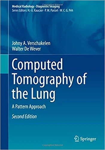 Coperta cărții "Computed Tomography of the Lung: A Pattern Approach" de Johny A. Verschakelen, Walter De Wever