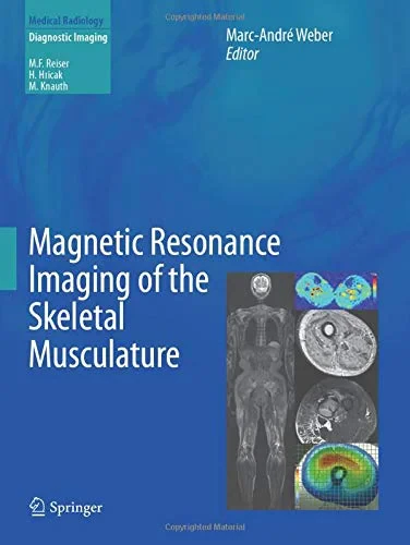 Coperta cărții "Magnetic Resonance Imaging of the Skeletal Musculature" de Weber, Marc-André