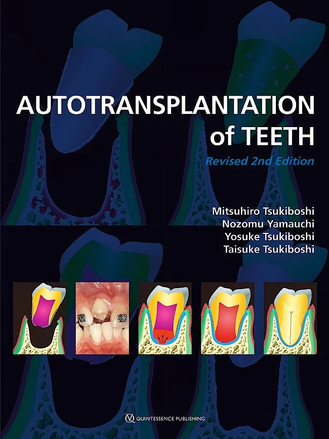 Coperta cărții "Autotransplantation of Teeth" de Mitsuhiro Tsukiboshi / Nozomu “Noz” Yamauchi / Yosuke Tsukiboshi / Taisuke Tsukibosh