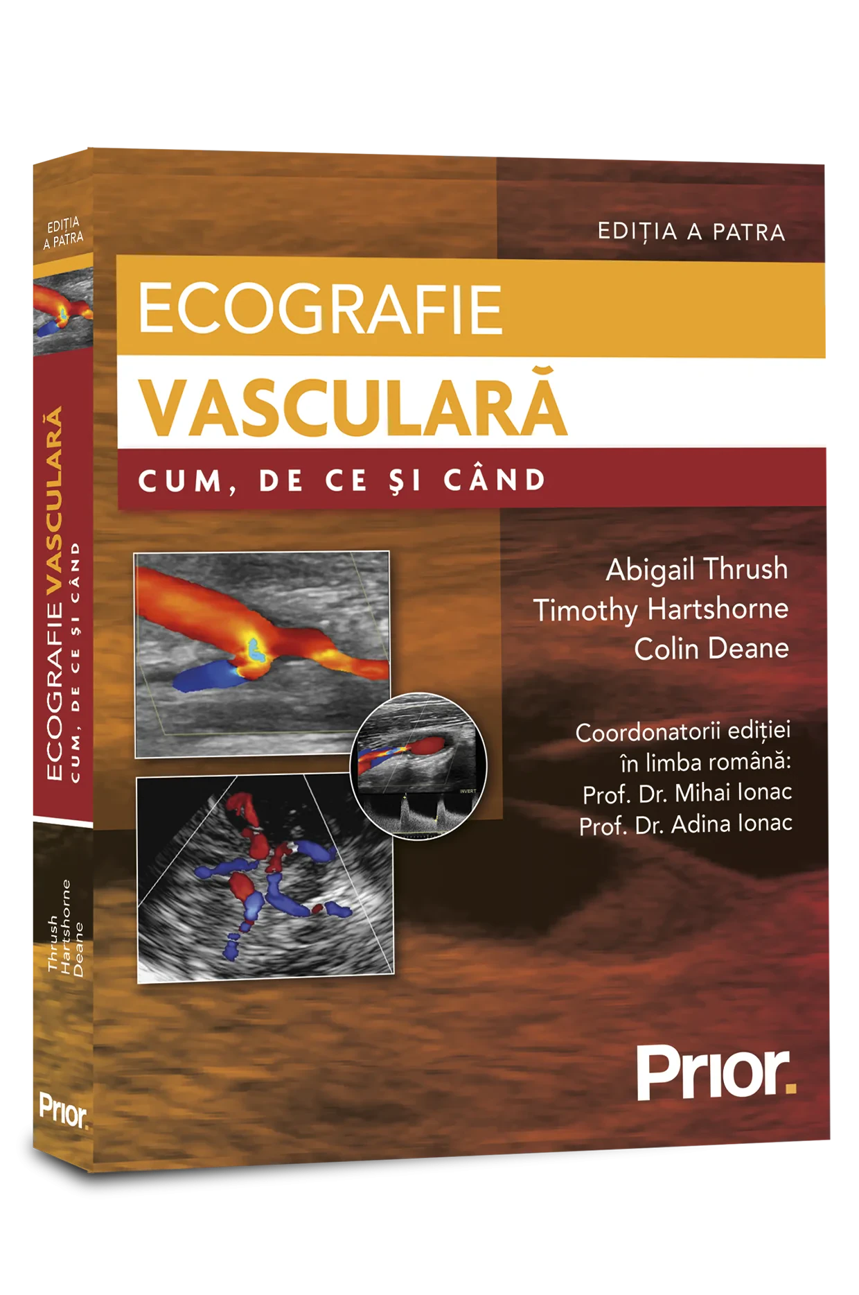Coperta cărții "Ecografie vasculara. Cum, de ce si cand" de Abigail Thrush, Timothy Hartshorne, Colin Deane Coordonatorii editiei in lb. romana: Prof. Dr. Mihai Ionac, Prof. Dr. Adina Ionac