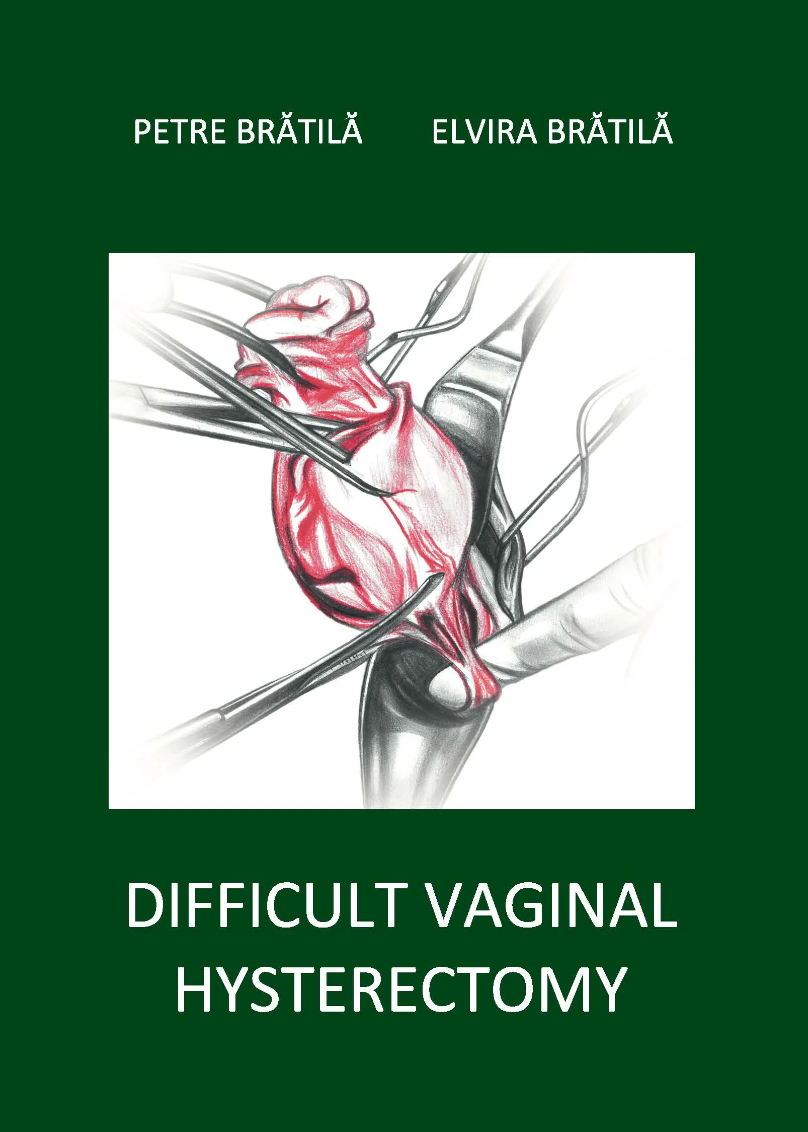 Coperta cărții "Difficult vaginal hysterectomy" de Petre Bratila, Elvira Bratila