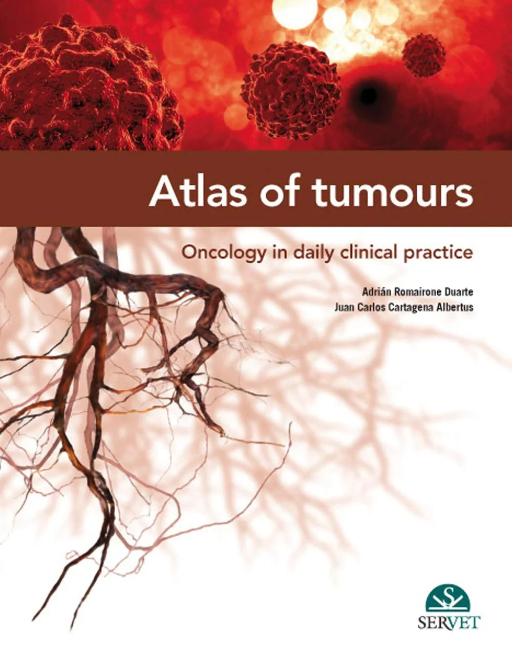 Coperta cărții "Atlas of Tumours - Oncology in Daily Clinical Practice " de Adrián Romairone Duarte Juan Carlos Cartagena Albertus