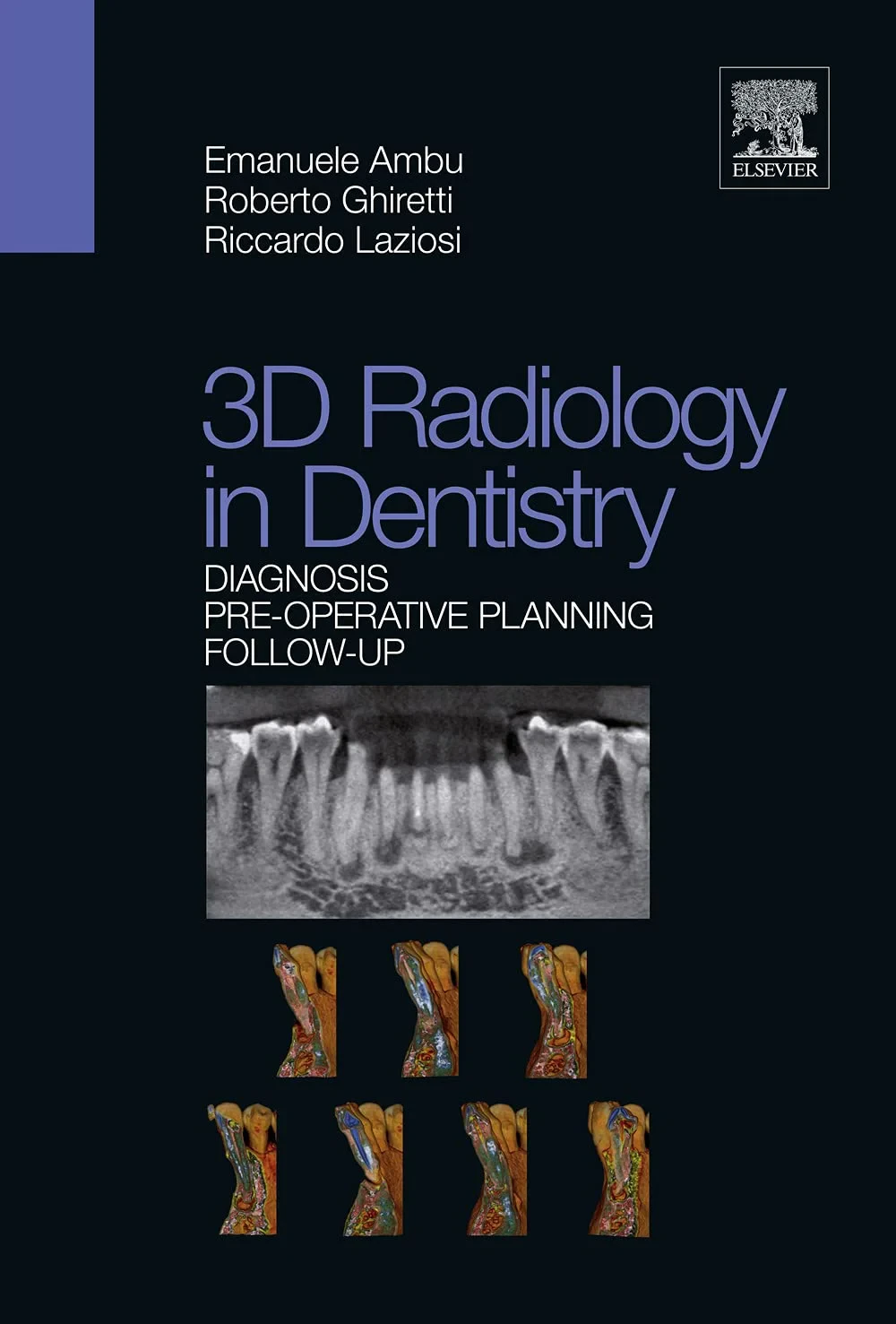 Coperta cărții "3D radiology in dentistry - Diagnosis Pre-operative Planning Follow-up " de Riccardo Laziosi