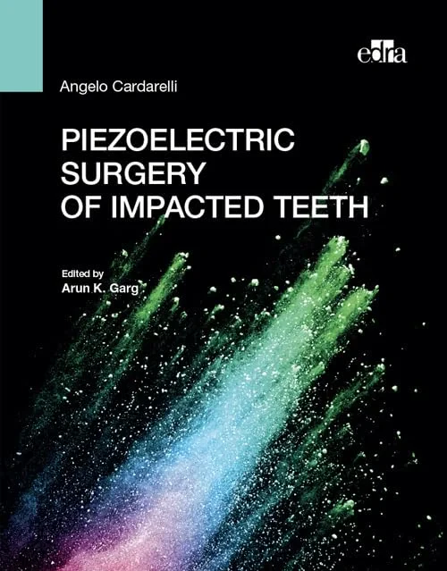 Coperta cărții "Piezoelectric surgery of impacted teeth" de Angelo Cardarelli