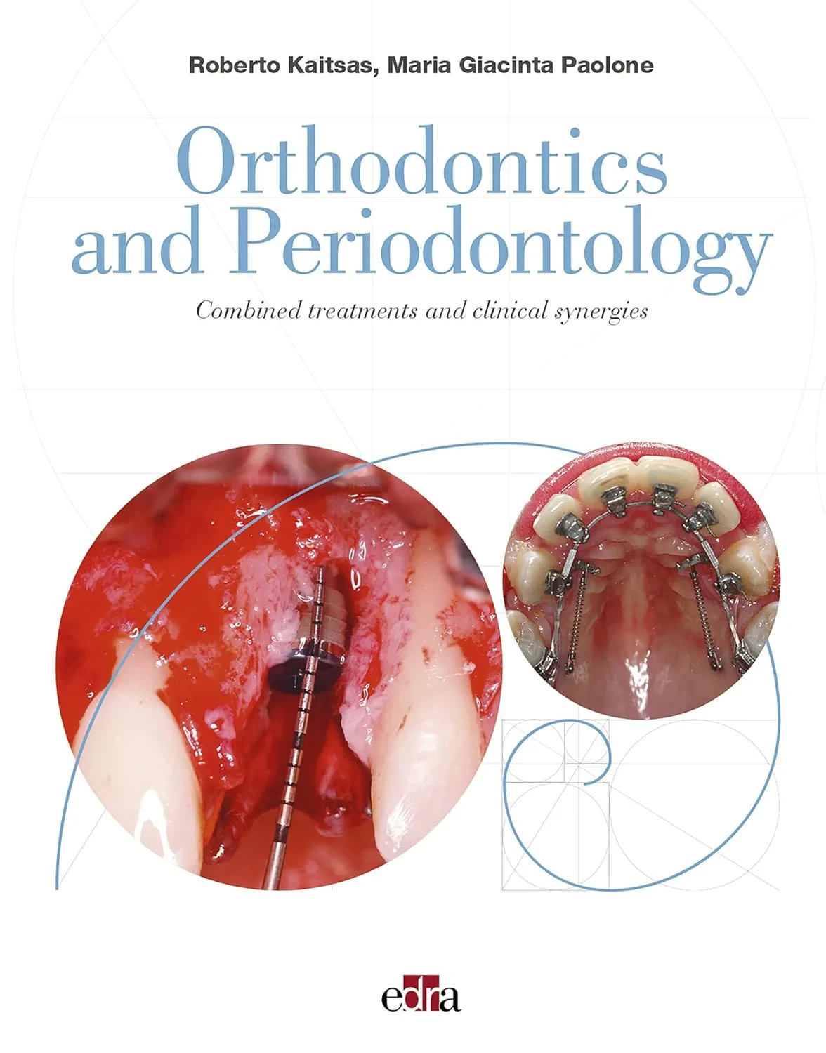 Coperta cărții "Orthodontics and Periodontology" de Maria Giacinta Paolone, Roberto Kaitsas
