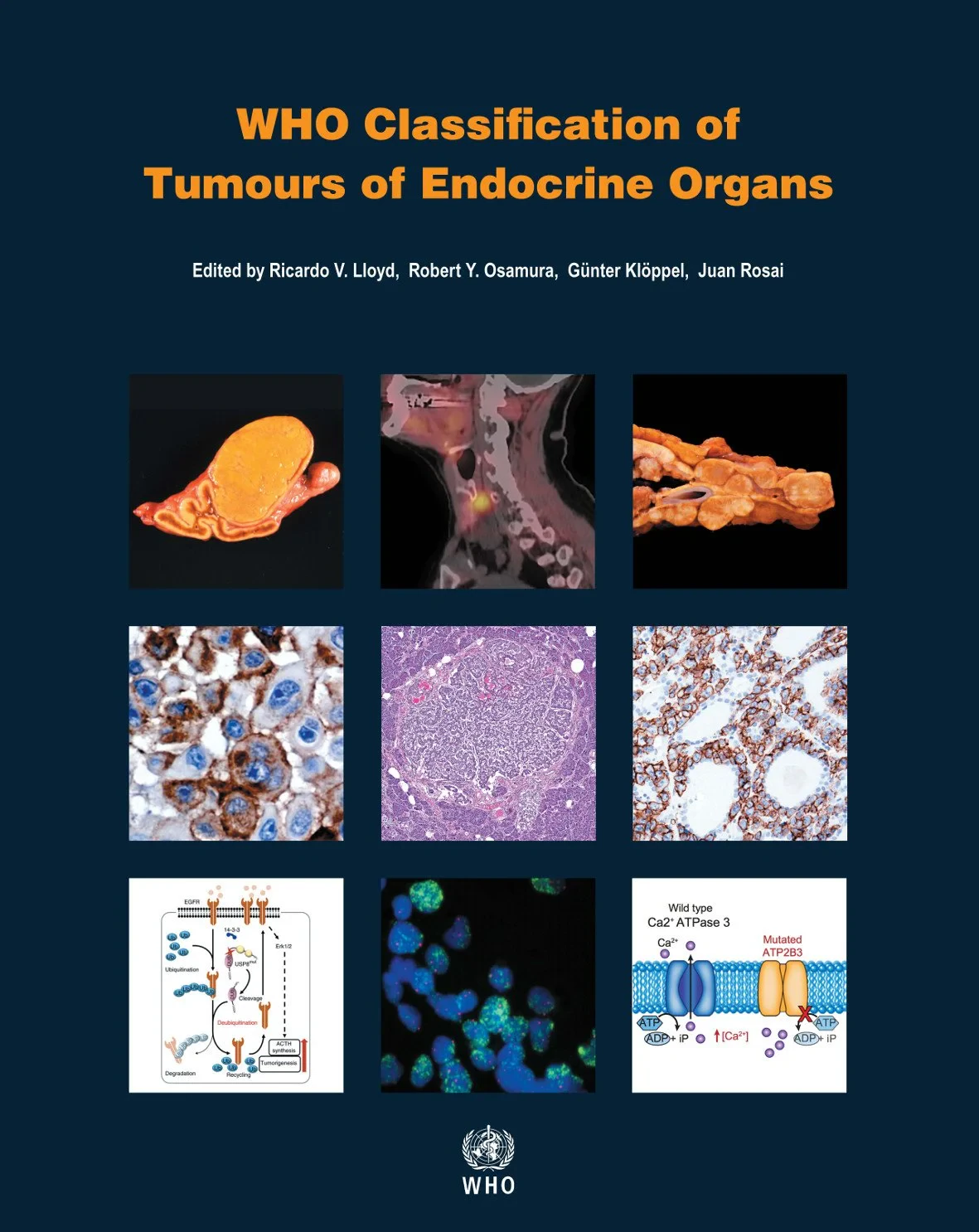 WHO classification of tumours of endocrine organs ...