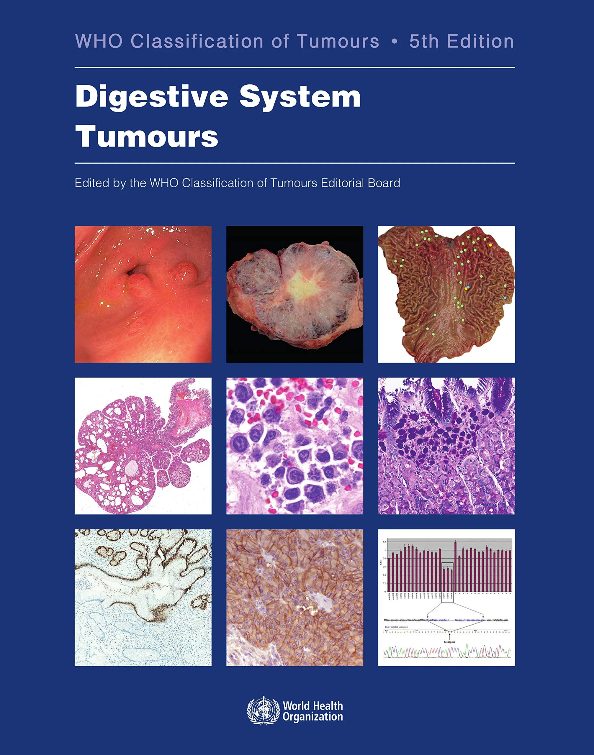 Digestive System Tumours (Who Classification of Tu...