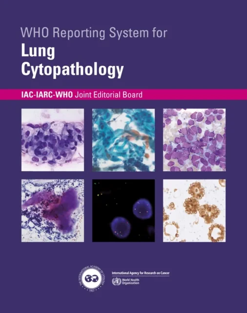 Coperta cărții "Who Reporting System for Lung Cytopathology" de Iac-Iarc-Who Joint Editorial Board