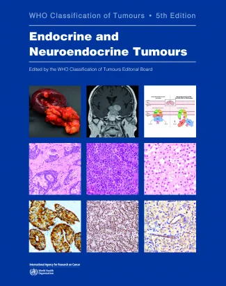 WHO Classification of Endocrine and Neuroendocrine...