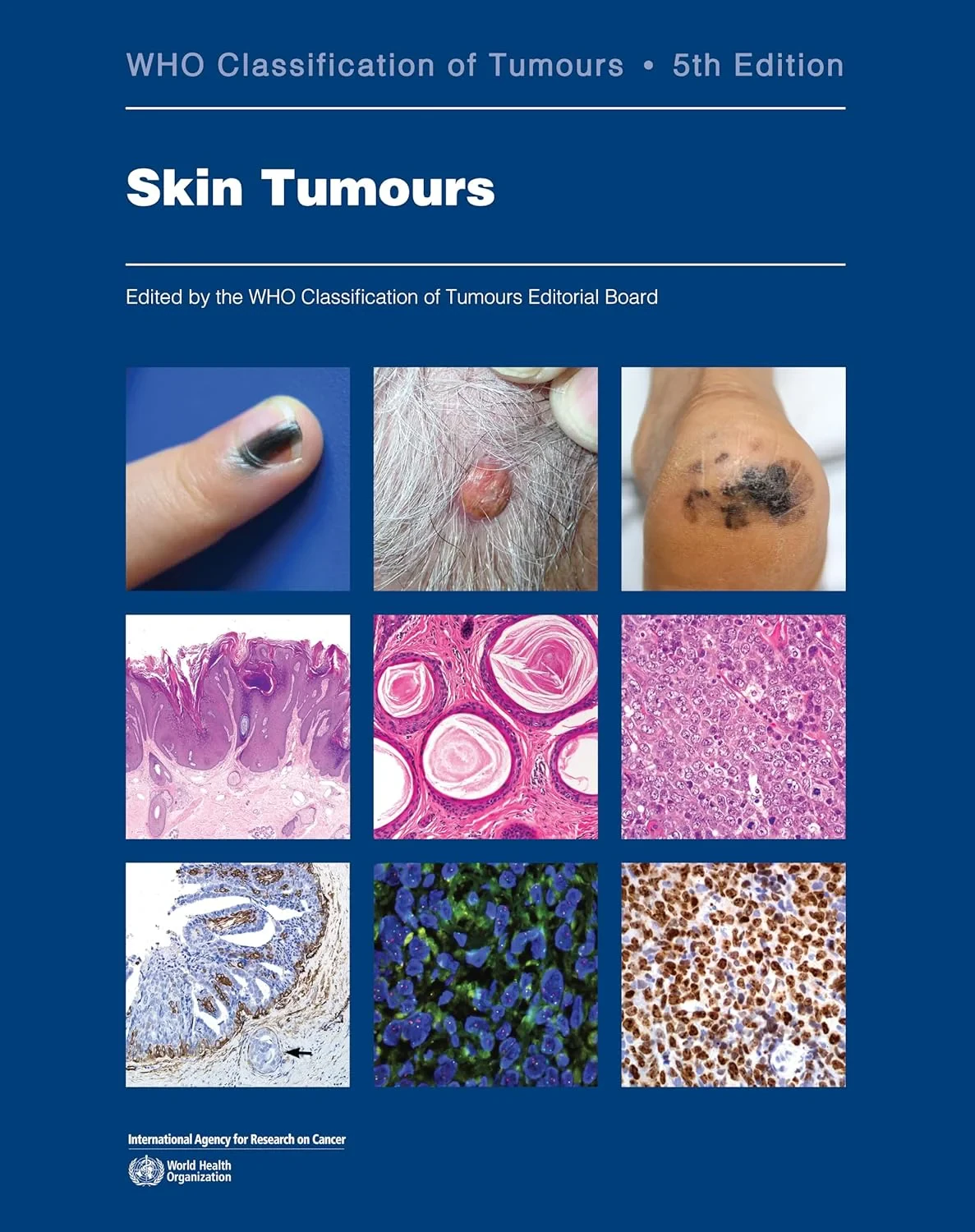 WHO Classification of Tumours. Skin Tumours, 5th e...