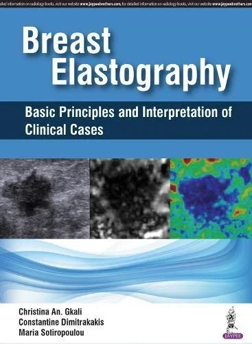 Coperta cărții "Breast Elastography: Basic Principles and Interpretation of Clinical Cases" de Christina An Gkali, Constantine Dimitrakakis, Maria Sotiropoulou
