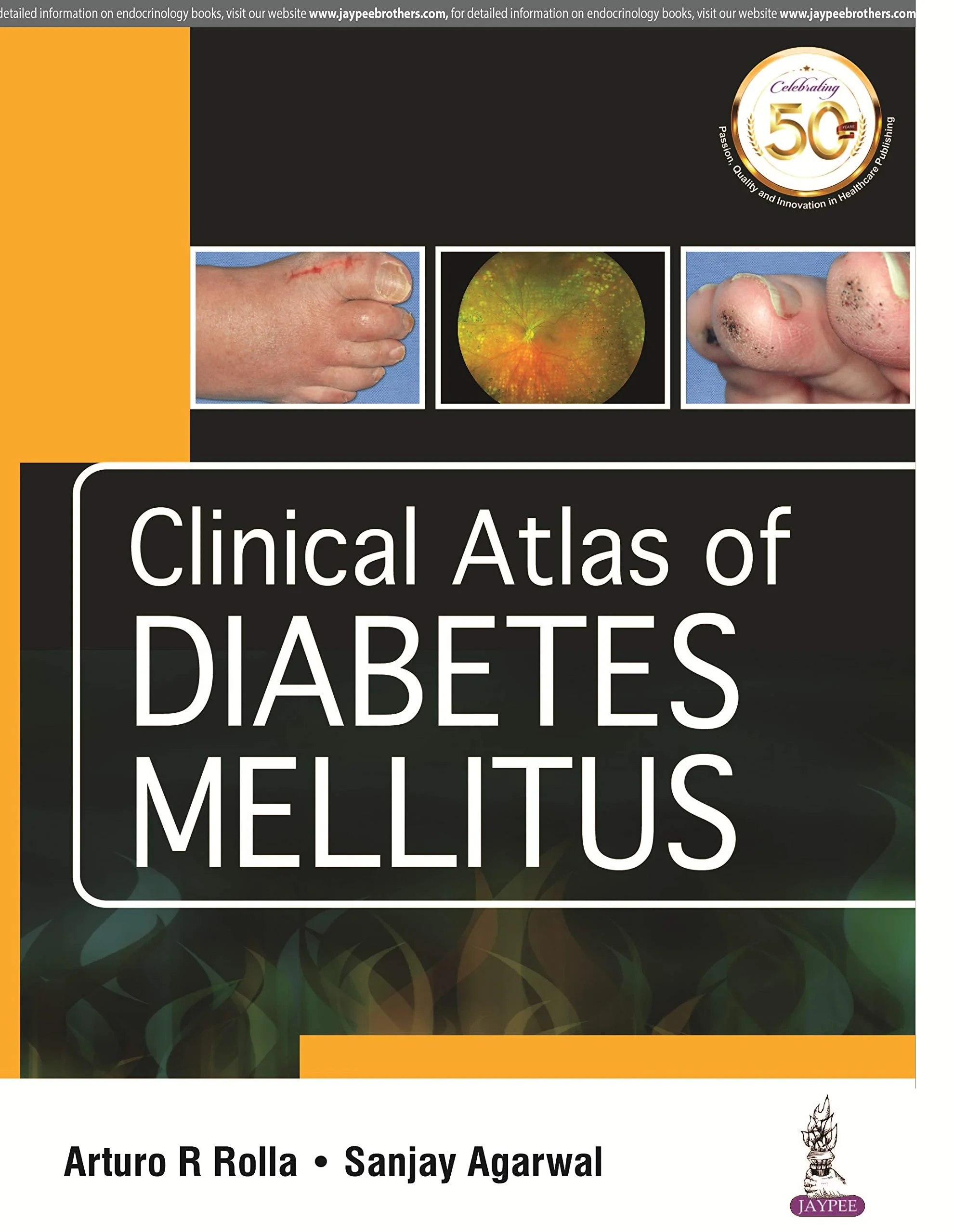 Coperta cărții "Clinical Atlas of Diabetes Mellitus" de Arturo R Rolla, Sanjay Agarwal