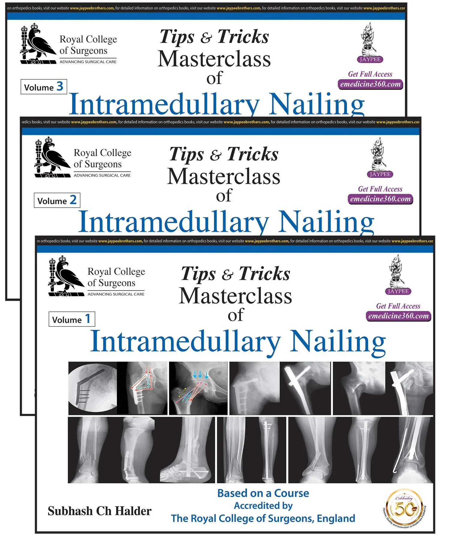 Tips and Tricks: Masterclass of Intramedullary Nai...