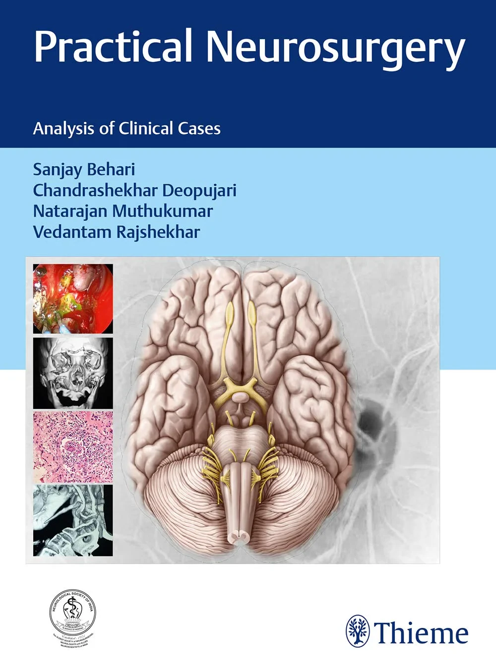 Coperta cărții "Practical Neurosurgery: Analysis of Clinical Cases " de Behari S.