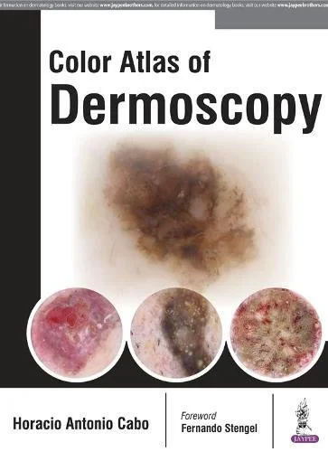 Coperta cărții "Color Atlas of Dermoscopy" de Horacio Cabo