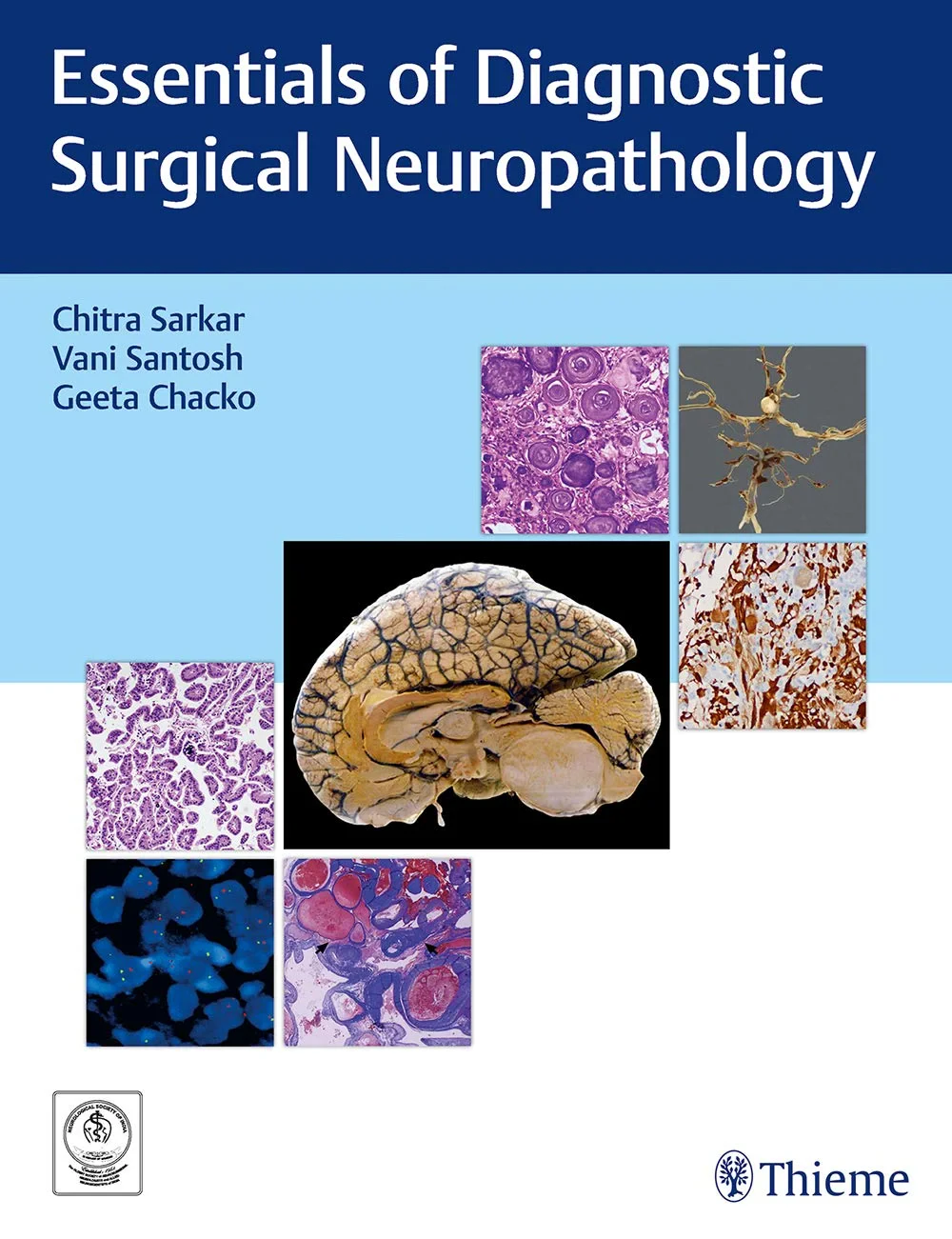 Coperta cărții "Essentials of Diagnostic Surgical Neuropathology" de Chitra Sarkar, Vani Santosh, Geeta Chacko