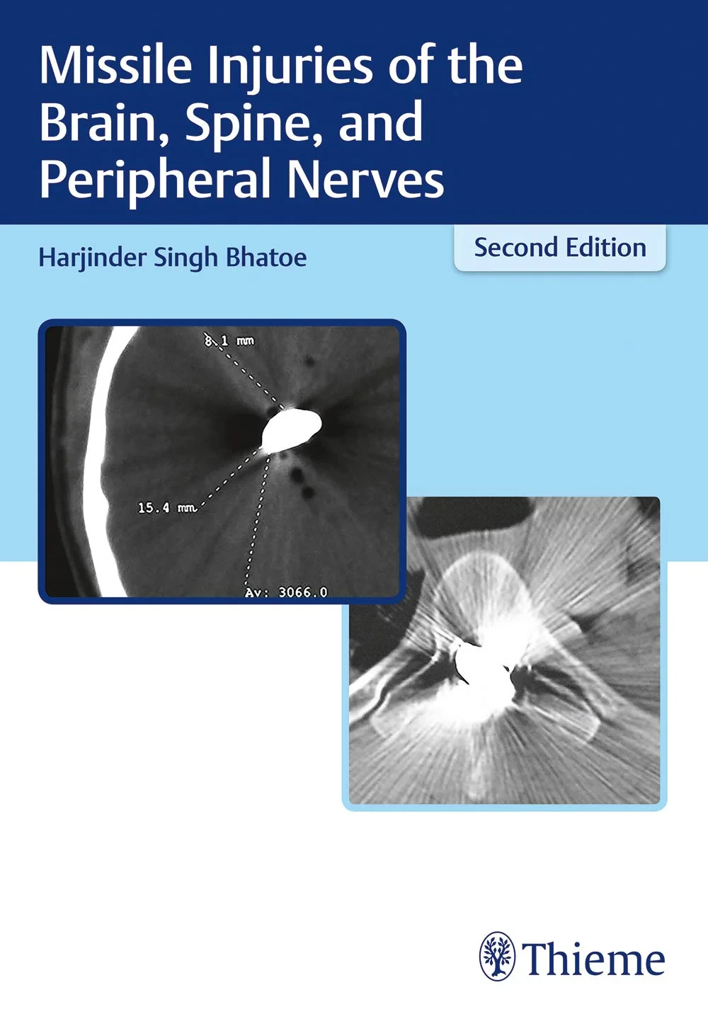 Coperta cărții "Missile Injuries of the Brain, Spine, and Peripheral Nerves" de Harjinder S. Bhatoe