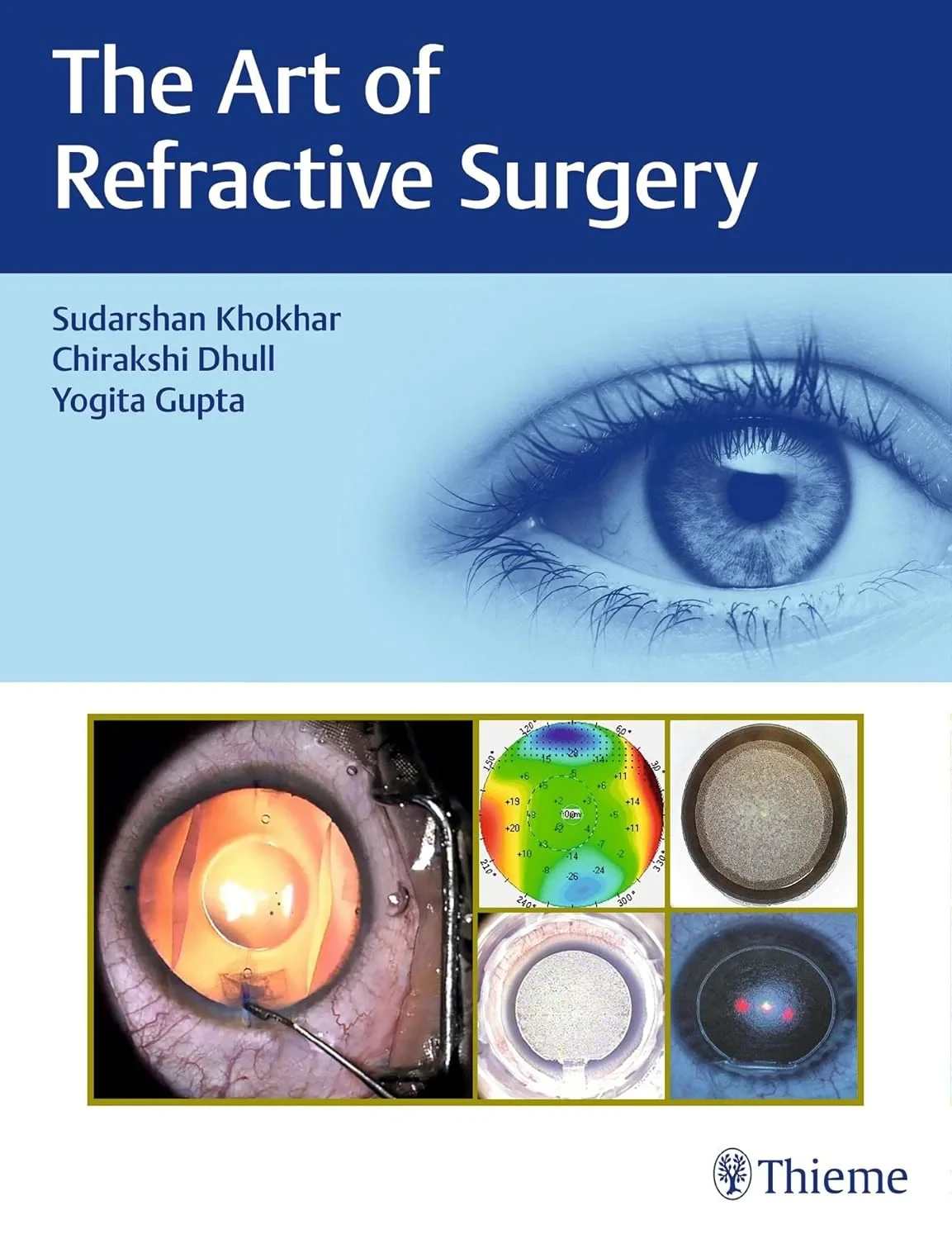Coperta cărții "The Art of Refractive Surgery" de Chirakshi Dhull, Sudarshan Khokhar, Yogita Gupta